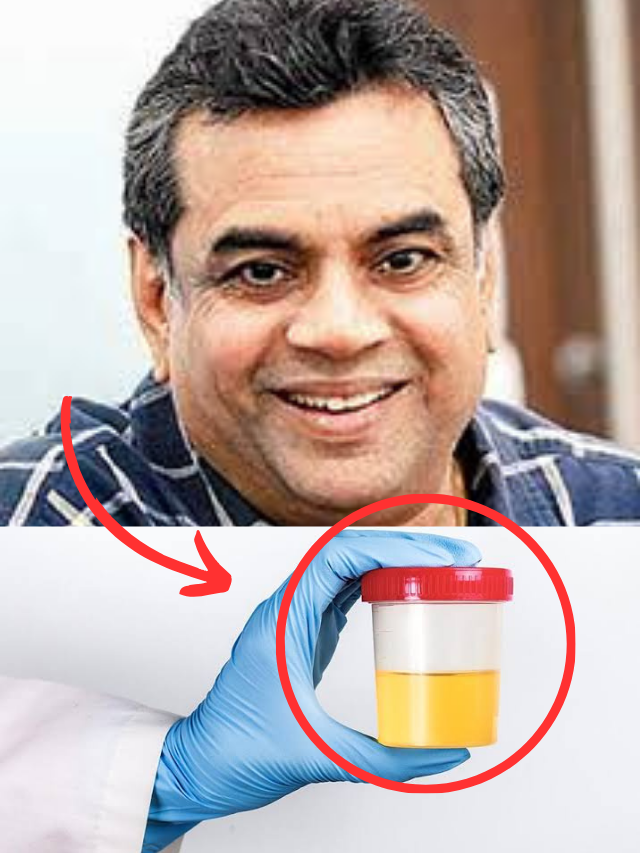 जब परेश रावल ने पिया अपना ही यूरिन – जानें वजह!